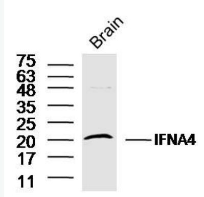 Anti-IFNA4  antibody-干扰素α4抗体