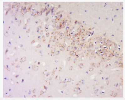 Anti-Klrb1c antibody-NKR-P1C（NK1.1）抗体