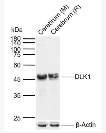 Anti-DLK1 antibody-穿膜蛋白DLK1抗体（C端）