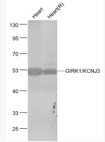 Anti-GIRK1/KCNJ3  antibody-G蛋白激活内向钾通道1抗体