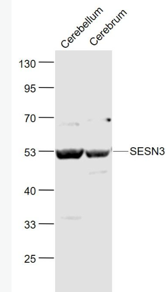 Anti-SESN3 antibody-Sestrin3抗体