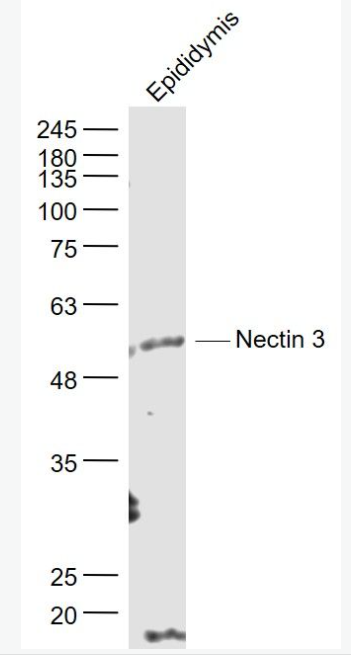 Anti-Nectin 3 antibody-连接蛋白3抗体