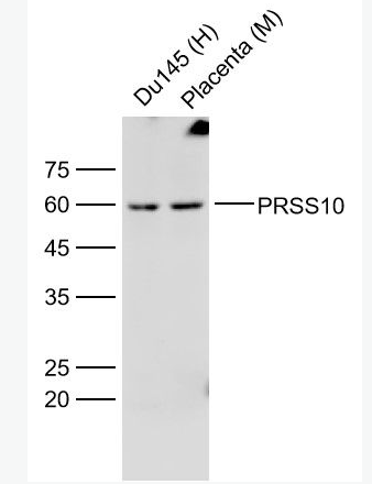 Anti-PRSS10 antibody-丝氨酸蛋白酶10抗体