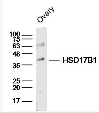 Anti-HSD17B1 antibody-羟类固醇脱氢酶17β抗体