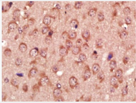 Anti-GAT1/GABA Transporter 1  antibody-γ氨基丁酸运载蛋白1抗体