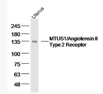 Anti-MTUS1 antibody-微管相关肿瘤抑制因子1 抗体