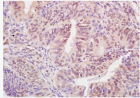 Anti-BARD1 antibody-乳腺癌易感基因环状结构域蛋白抗体