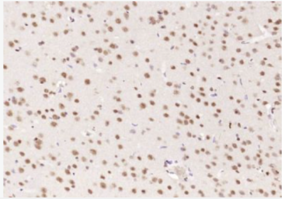 Anti-Alpha B Crystallin antibody-α晶状体球蛋白B/αB-crystallin抗体