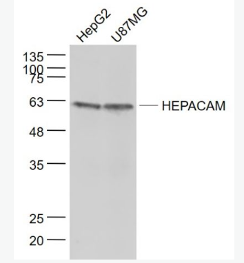 Anti-HEPACAM antibody-肝细胞粘附分子抗体