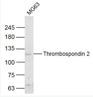 Anti-Thrombospondin 2 antibody-血小板反应蛋白2/凝血酶敏感蛋白2抗体