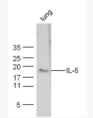 Anti-IL-6 antibody-白介素6抗体