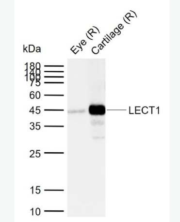 Anti-LECT1 antibody-白细胞衍生化学吸引素抗体