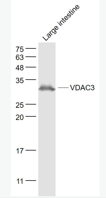 Anti-VDAC3  antibody-线粒体外膜孔蛋白3/电压依赖阴离子通道蛋白3抗体