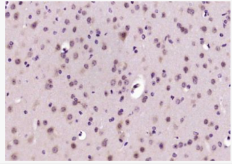 Anti-CARD7/NALP1 antibody-凋亡加强结构域蛋白7抗体