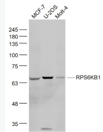 Anti-RPS6KB1 antibody-核糖体p70 S6蛋白激酶抗体