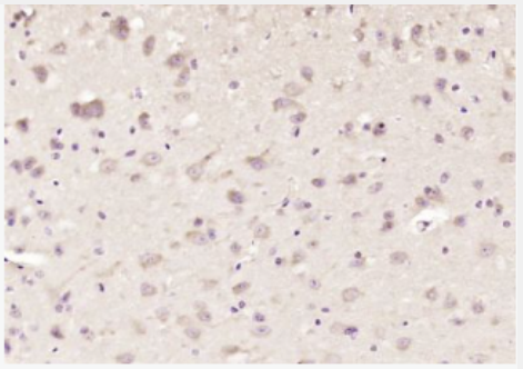 Anti-FOXO1 + FOXO3 + FOXO4 antibody-叉头蛋白O1/O3/O4抗体