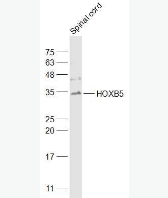 Anti-HOXB5 antibody-同源盒蛋白HOXB5抗体