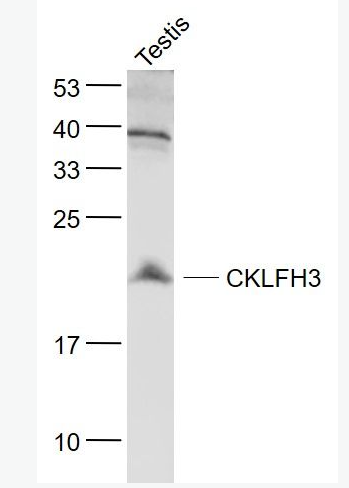 Anti-CKLFH3 antibody-趋化素样因子超家族成员3抗体