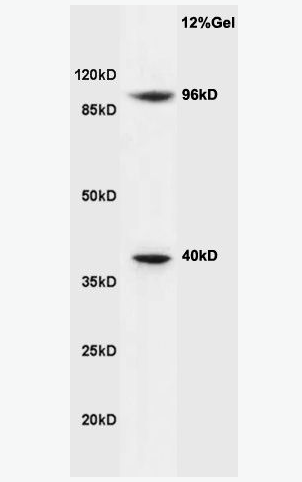 Anti-Cyclin M2 antibody-周期素M2抗体