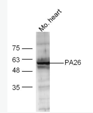 Anti-PA26 antibody-p53调控PA26核蛋白抗体