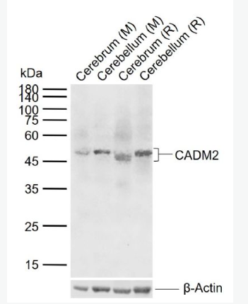 Anti-CADM2 antibody-细胞粘附分子2抗体
