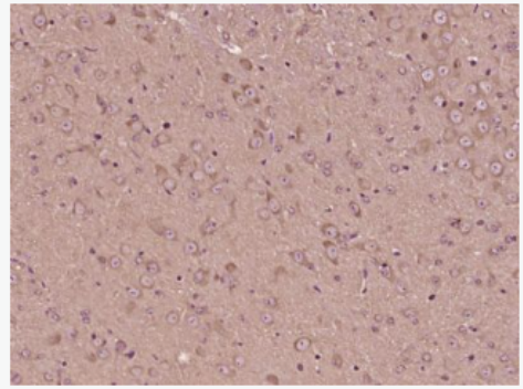 Anti-TRPM3 antibody-瞬时受体电位离子通道蛋白3（M亚家族）抗体