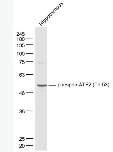 Anti-phospho-ATF2 (Thr53) antibody-磷酸化活化复制因子2抗体