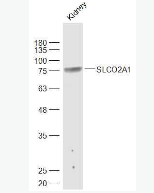 Anti-SLCO2A1 antibody-溶质载体蛋白家族21成员2抗体