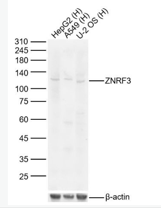 Anti-ZNRF3 antibody-锌指蛋白3/环指蛋白3抗Anti-ZNRF3 antibody-锌指蛋白3/环指蛋白3抗体体