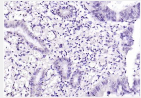 Anti-FIGNL1 antibody-FIGNL1蛋白抗体