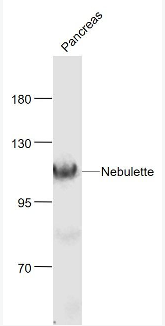 Anti-Nebulette antibody-肌动蛋白结合蛋白Z盘状蛋白抗体