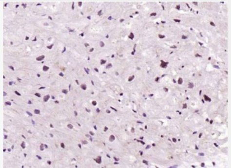 Anti-Titin antibody-扩张型心肌病蛋白1G抗体