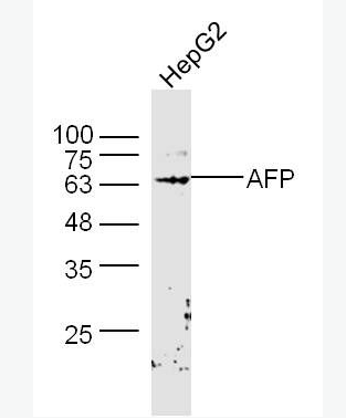 Anti-AFP antibody-甲胎蛋白AFP抗体