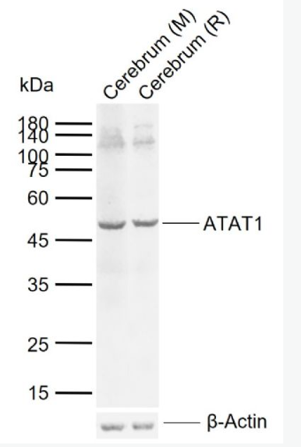 Anti-ATAT1 antibody-α微管蛋白乙酰转移酶1抗体