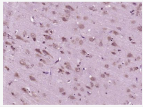 Anti-MOBP antibody-少突胶质细胞髓鞘相关蛋白抗体