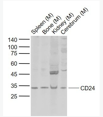 Anti-CD24 antibody-CD24抗体