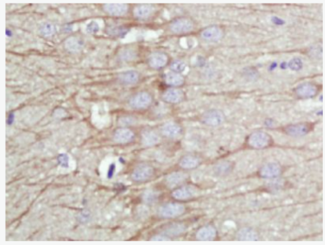 Anti-KCNMA1/BK channel antibody-钙激活钾通道蛋白α1抗体