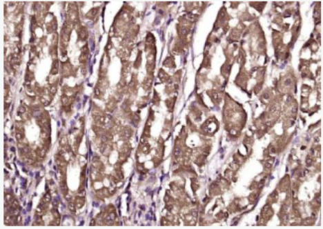 Anti-Cytohesin 2  antibody-胞粘蛋白2抗体