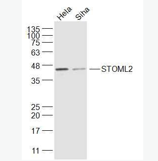 Anti-STOML2 antibody-溴化丙胺太林相关蛋白2抗体