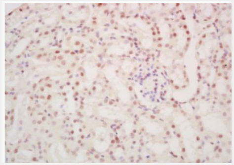 Anti-SALL1 antibody-锌指转录蛋白Sall1抗体