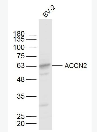 Anti-ACCN2 antibody-脑钠通道蛋白2抗体