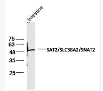 Anti-SLC38A2 antibody-氨基酸转运蛋白2抗体