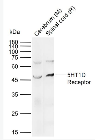 Anti-5HT1D Receptor  antibody-5-羟色胺受体1D抗体