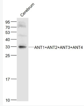 Anti-ANT1+ANT2+ANT3+ANT4 antibody-腺嘌呤核苷酸转运蛋白1、2、3、4抗体