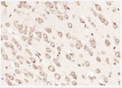 Anti-CSAD antibody-半胱氨酸亚磺酸脱羧酶抗体