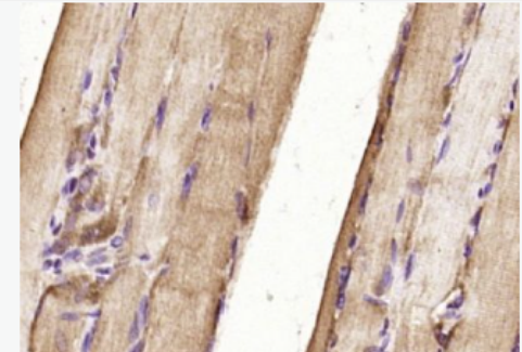 Anti-UCHL3 antibody-泛素硫酯酶L3抗体