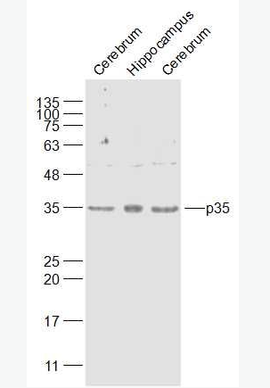 Anti-CDK5R1/p35 antibody-细胞周期蛋白依赖性激酶5激活因子1抗体