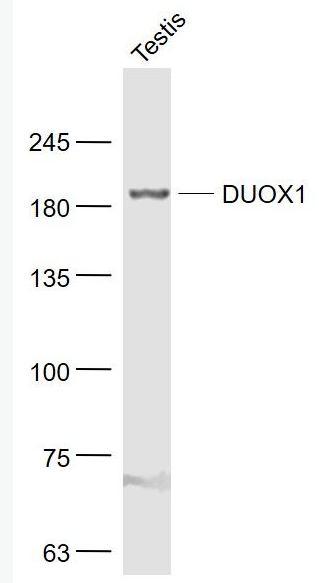 Anti-DUOX1 antibody-双氧化酶1/甲状腺氧化酶1抗体