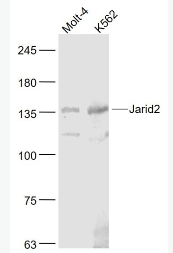 Anti-Jarid2 antibody-组蛋白去甲基化酶JARID2抗体