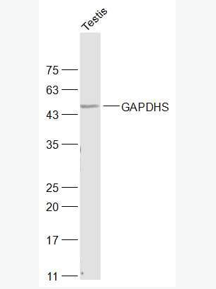 Anti-GAPDHS antibody-精子3-磷酸甘油醛脱氢酶-2抗体